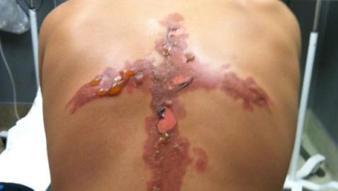 s-SALT-BURN-large640