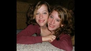 abby and brittany hensel