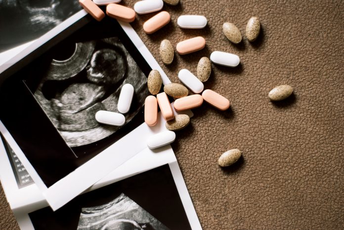 Photo,Of,The,Fetus,On,An,Ultrasound,Scan,And,Few JDJ_abortionpill